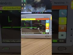 देखें कि फ्रंट कवर के साथ माइंड्रे बेनेव्यू टी1 पेशेंट मॉनिटर एलसीडी स्क्रीन क्यों चुनें