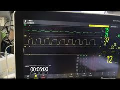 माइंड्रे एजी मॉड्यूल एजी और ओ2 मॉड्यूल एमएमएस मॉड्यूल पीएन 115-023943-00 डेमो देखें
