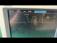 एक नज़दीकी नज़र: 9200-10-10530 वयस्क बाल चिकित्सा एनेस्थीसिया गैस मॉड्यूल के लिए माइंड्रे वॉटर ट्रैप